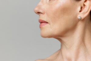 What Causes Premature Skin Aging - mendoza med spa kenner