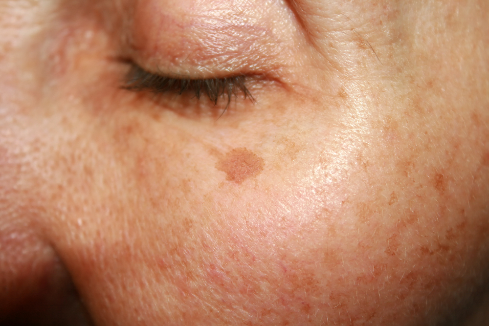 mendoza med spa - clinica hispana in kenner