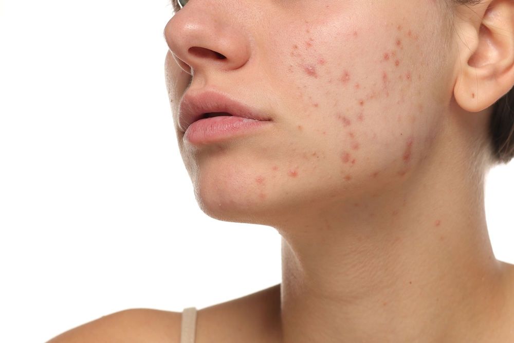 mendoza med spa - clinica hispana in kenner